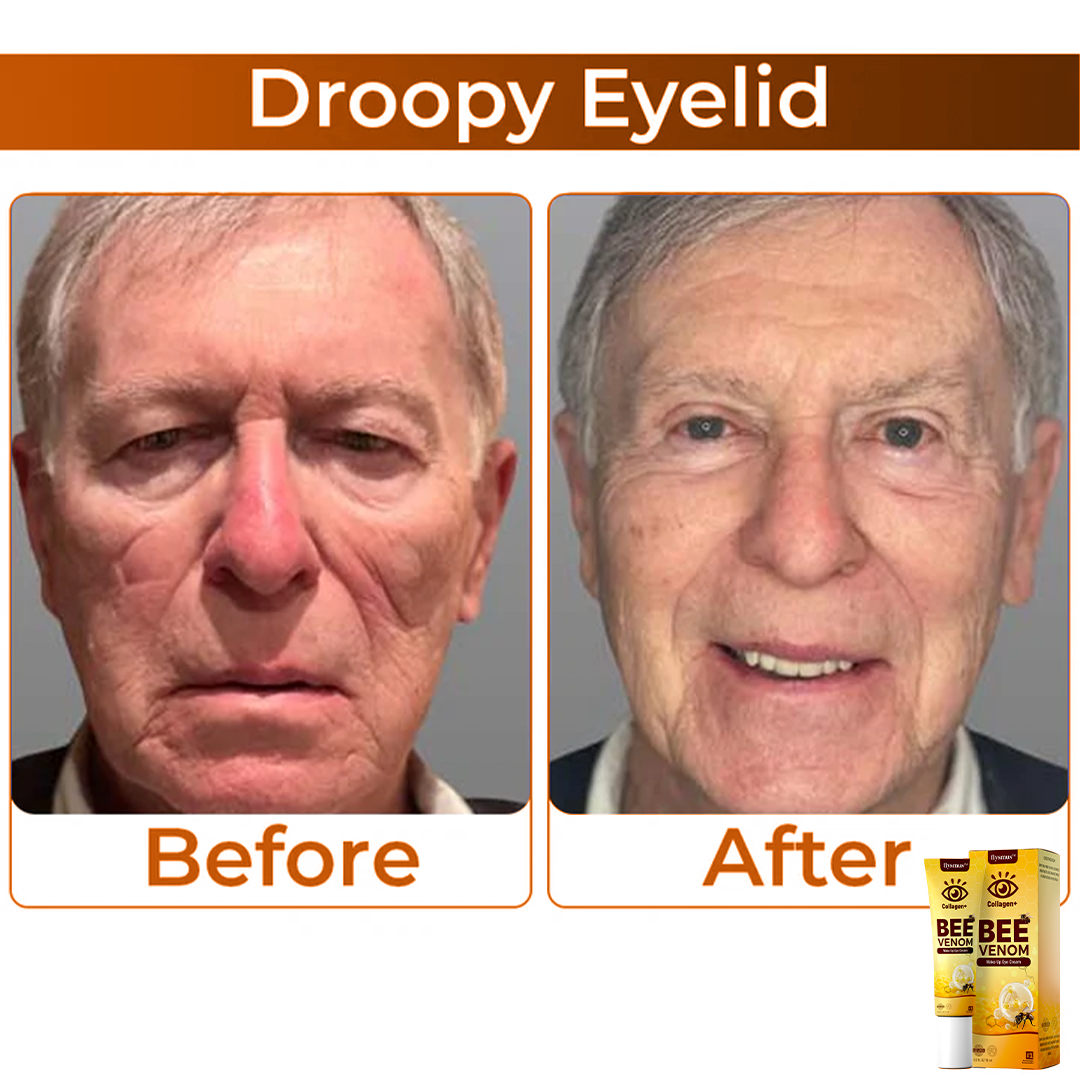 BeeVenom™ – Oogcrème met Bijengif voor Stralende Jeugdige Huid [1 + 1 Gratis]