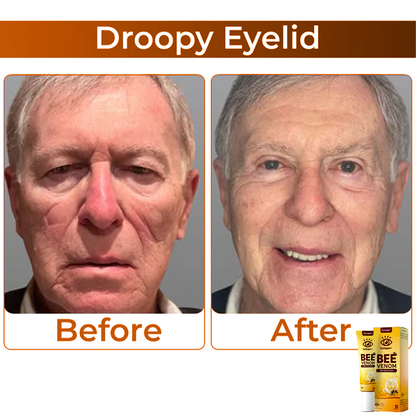 BeeVenom™ – Oogcrème met Bijengif voor Stralende Jeugdige Huid [1 + 1 Gratis]