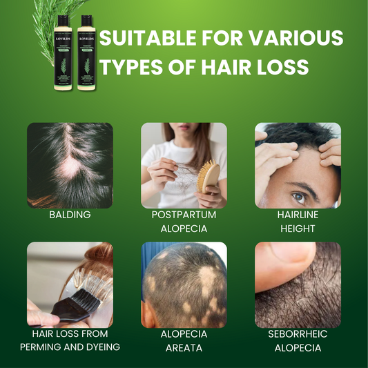 LOVILDS™ – Voor voller, dichter haar met gezond, sterk & glanzend haargroei [50% Korting]