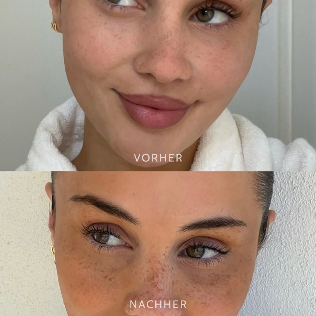 SpeckleTouch™ – Speels & opvallend beauty-accent [50% korting]