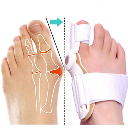 ToeSupport™ - Comfortabele uitlijning van de tenen [1 + 1 Gratis]