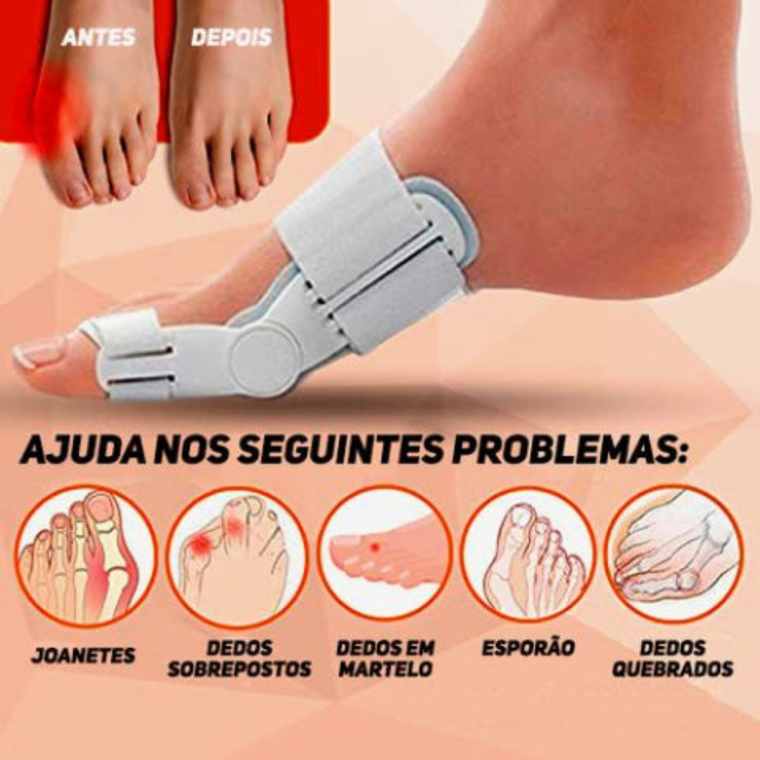 ToeSupport™ - Comfortabele uitlijning van de tenen [1 + 1 Gratis]