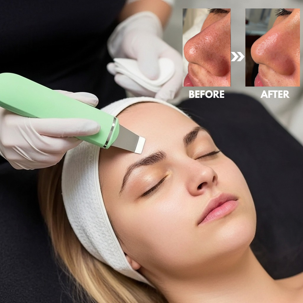 SkinSonic™ – Ultrasone Skin Scrubber voor Diepe Poriënreiniging & Stralende Huid