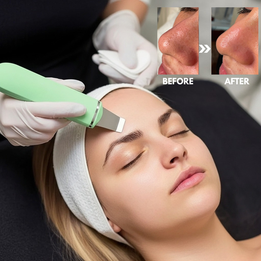 SkinSonic™ – Ultrasone huidreiniger voor diepe reiniging, zachte verzorging & stralende huid [50% Korting]