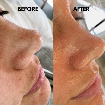 SkinSonic™ – Ultrasone Skin Scrubber voor Diepe Poriënreiniging & Stralende Huid