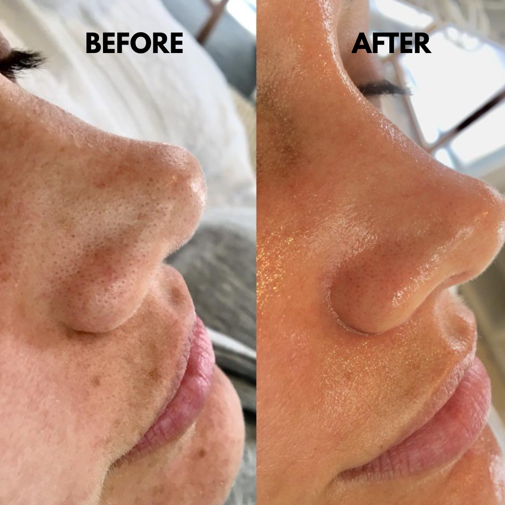 SkinSonic™ – Ultrasone Skin Scrubber voor Diepe Gezichtsreiniging & Stralende Huid