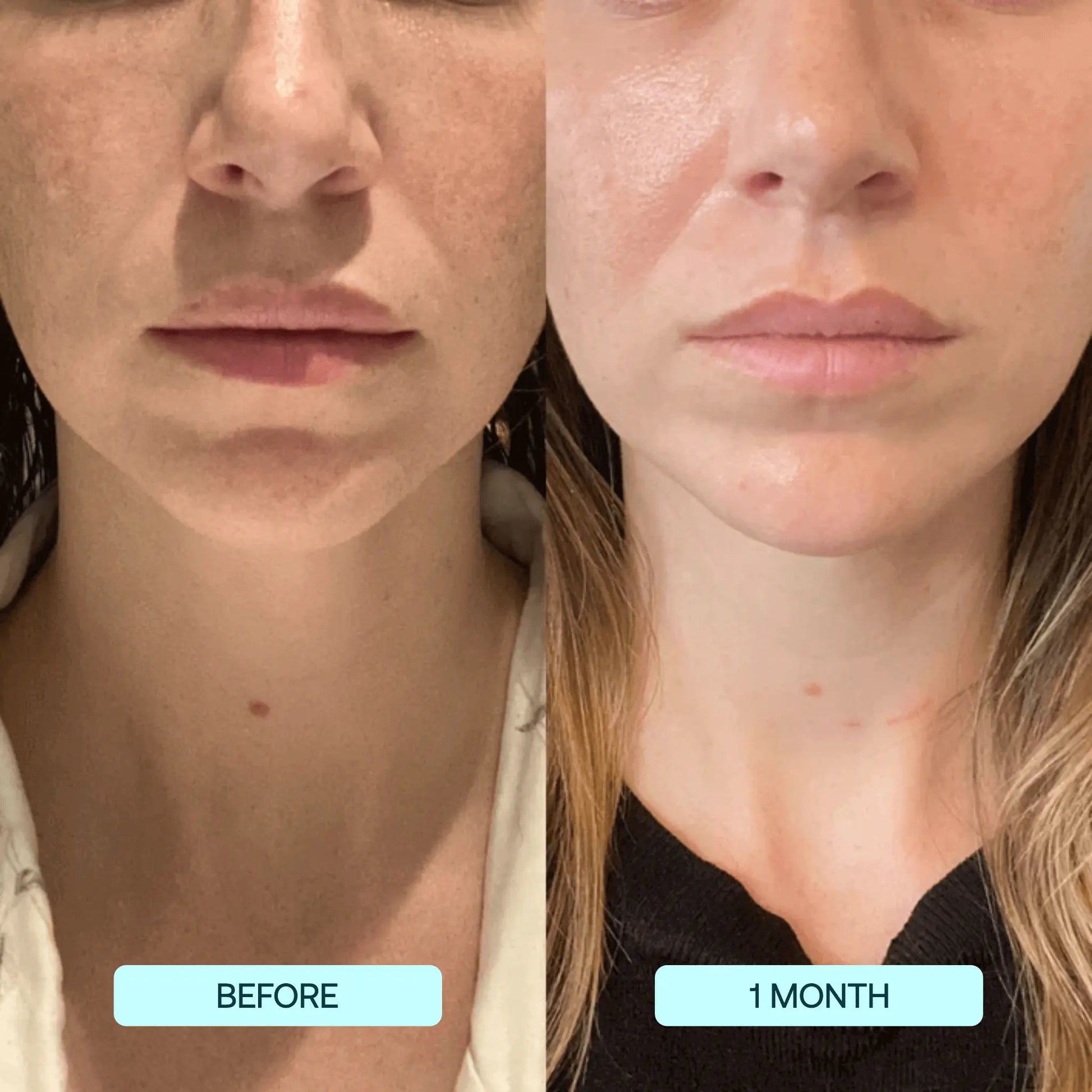 GlowSkin™ - Onmiddellijk een gladdere huid [1 + 1 Gratis]