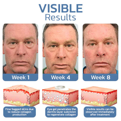 EyeRenew™ – Zichtbaar frisse oogcontour met liftend effect [50% Korting]