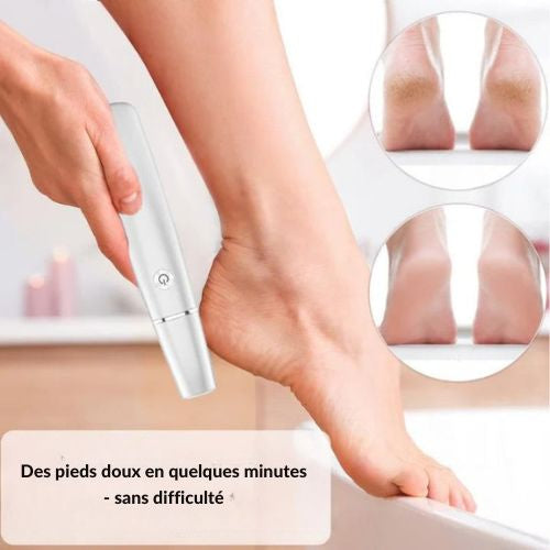 PediCare – Elektrische Eeltverwijdering voor zijdezachte voeten 50% Korting