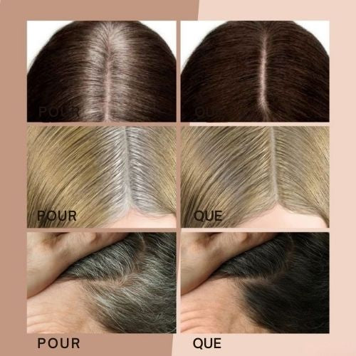 HairHalo™ – Zeg vaarwel tegen haaruitgroei in één oogopslag voor perfect haar [1 + 1 Gratis]