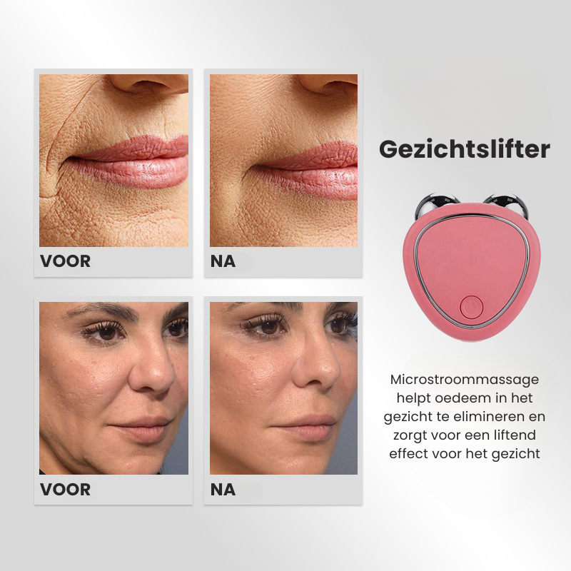 SkinVivo™ -Gezichtsmassageapparaat [50% Korting]