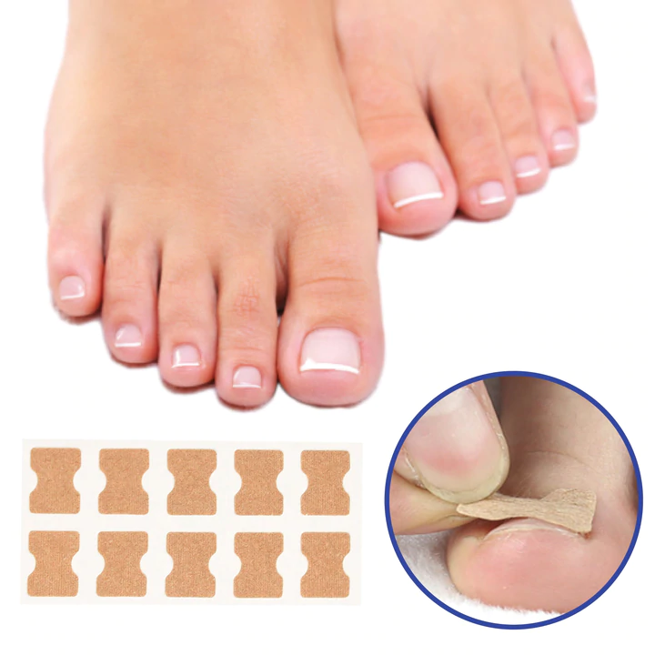 NailCare™ – Ingegroeide Nagels Corrigeren | Pijnvrije Voeten