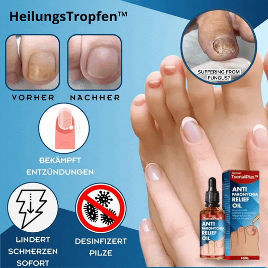 HeilungsTropfen™ – Beschadigde nagels in 4 weken snel & effectief herstellen [1 + 1 Gratis]