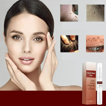 1 + 1 Gratis |  WipeOff™ - Verwijder hardnekkige vlekken en wratten [Laatste dag korting].