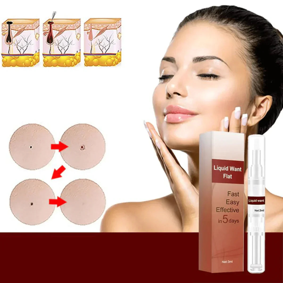 1 + 1 Gratis |  WipeOff™ - Verwijder hardnekkige vlekken en wratten [Laatste dag korting].