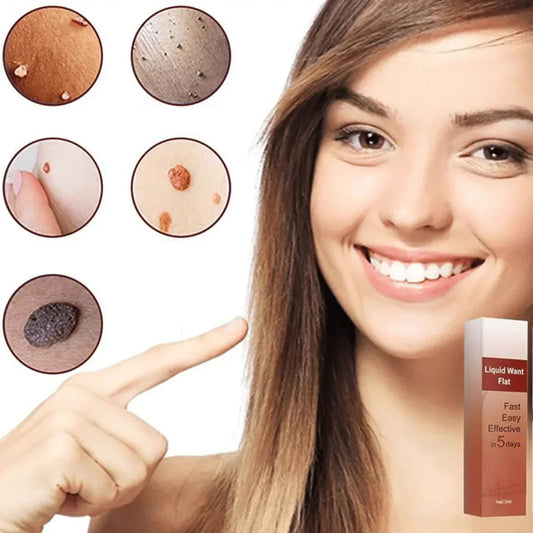 1 + 1 Gratis |  WipeOff™ - Verwijder hardnekkige vlekken en wratten [Laatste dag korting].