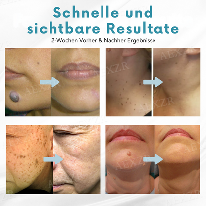 Radiant™ – Snelle, effectieve, zachte, natuurlijke en zichtbare huidverjonging [1 + 1 Gratis]
