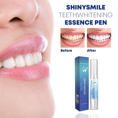 BrightEssence™ – Laat uw glimlach moeiteloos en zichtbaar stralen elke dag [1 + 1 Gratis]