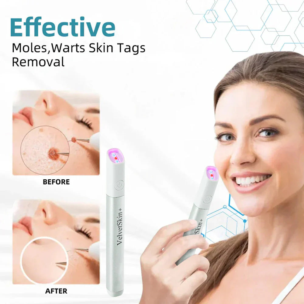 SkinRenew – Professionele CO₂ laser voor onberispelijke huid [50% korting]