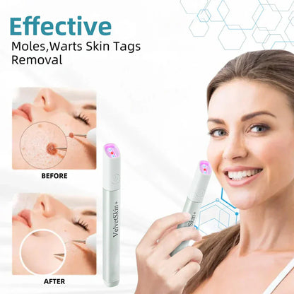 SkinRenew – Professionele CO₂ laser voor onberispelijke huid [50% korting]