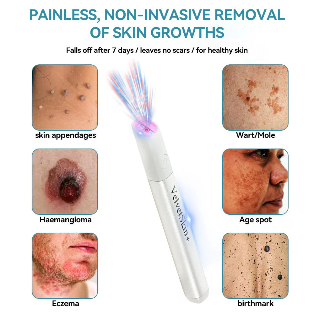 SkinRenew – Professionele CO₂ laser voor onberispelijke huid [50% korting]