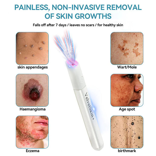 SkinRenew – Professionele CO₂ laser voor onberispelijke huid [50% korting]