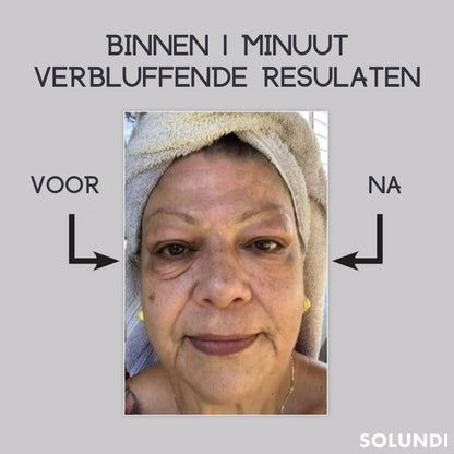 EyeRejuv™ – Verbazingwekkende oogcrème voor stralende, gladde & jeugdige huid [1 + 1 Gratis]