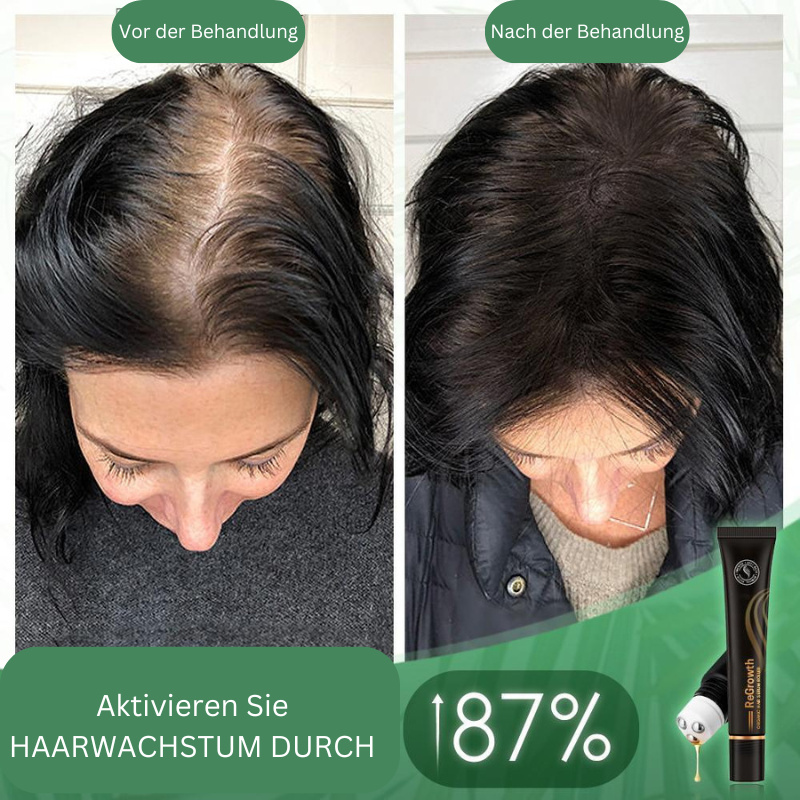 Regrowth – Natuurlijk Biologisch Haarserum-Roller voor zichtbaar voller haar [1 + 1 Gratis]