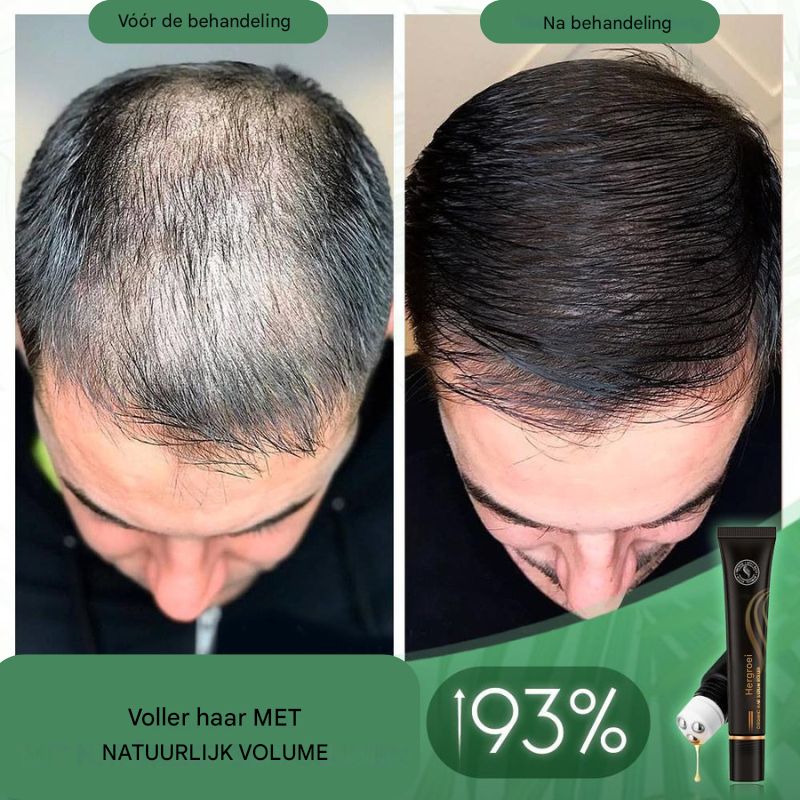Follicyn™ - Biologisch haarserum roller [1 + 1 Gratis]