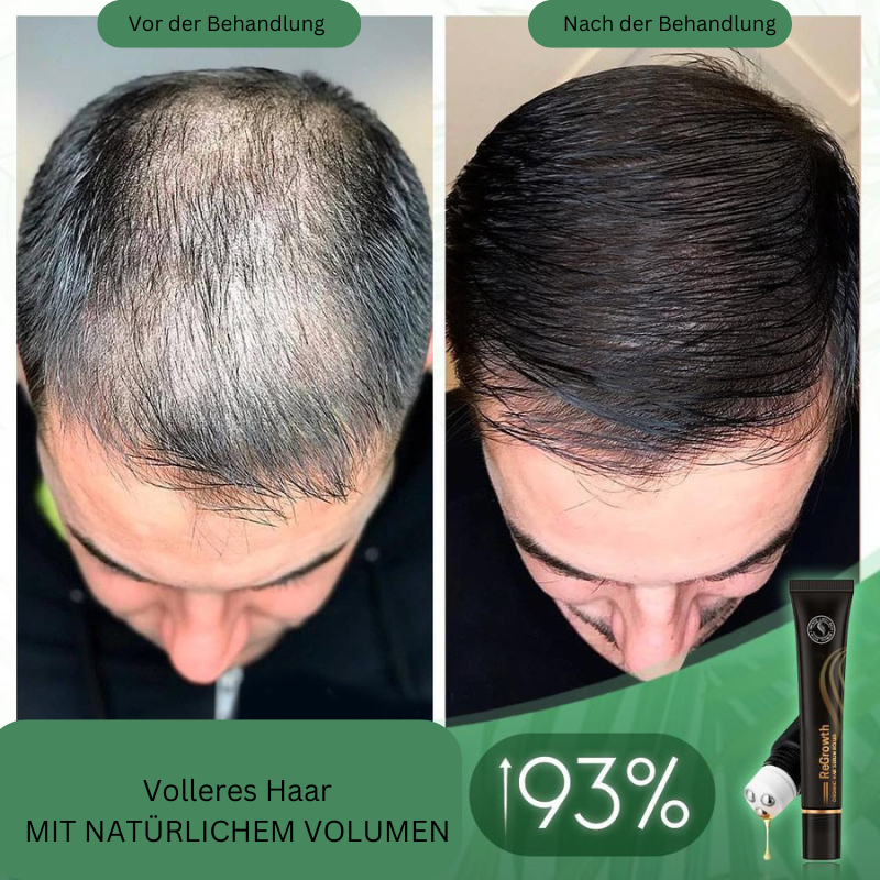 Regrowth – Natuurlijk Biologisch Haarserum-Roller voor zichtbaar voller haar [1 + 1 Gratis]