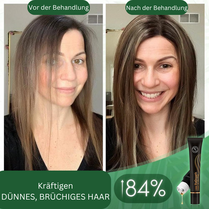 Regrowth – Natuurlijk Biologisch Haarserum-Roller voor zichtbaar voller haar [1 + 1 Gratis]