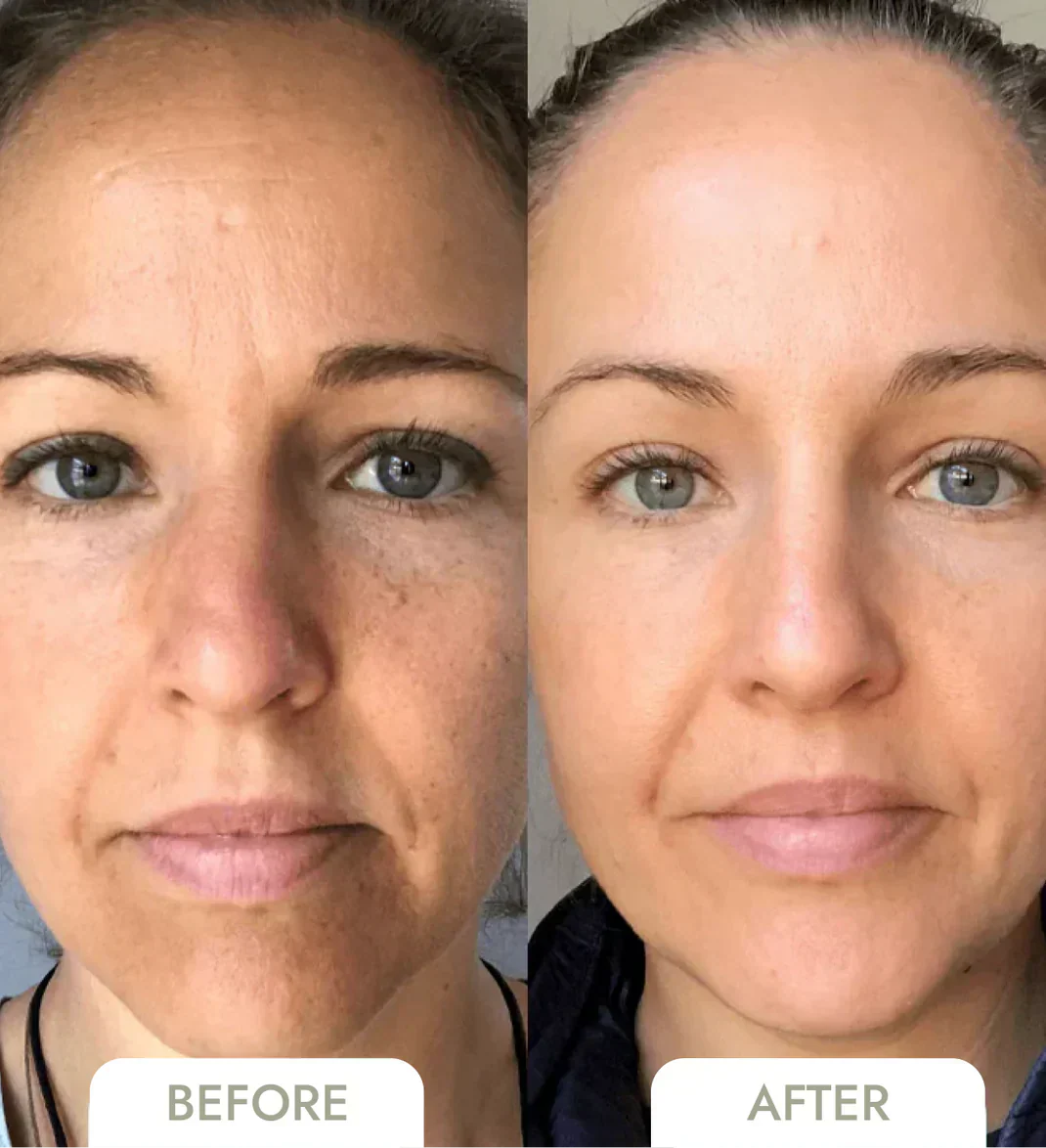 GlowSkin™ - Onmiddellijk een gladdere huid [1 + 1 Gratis]