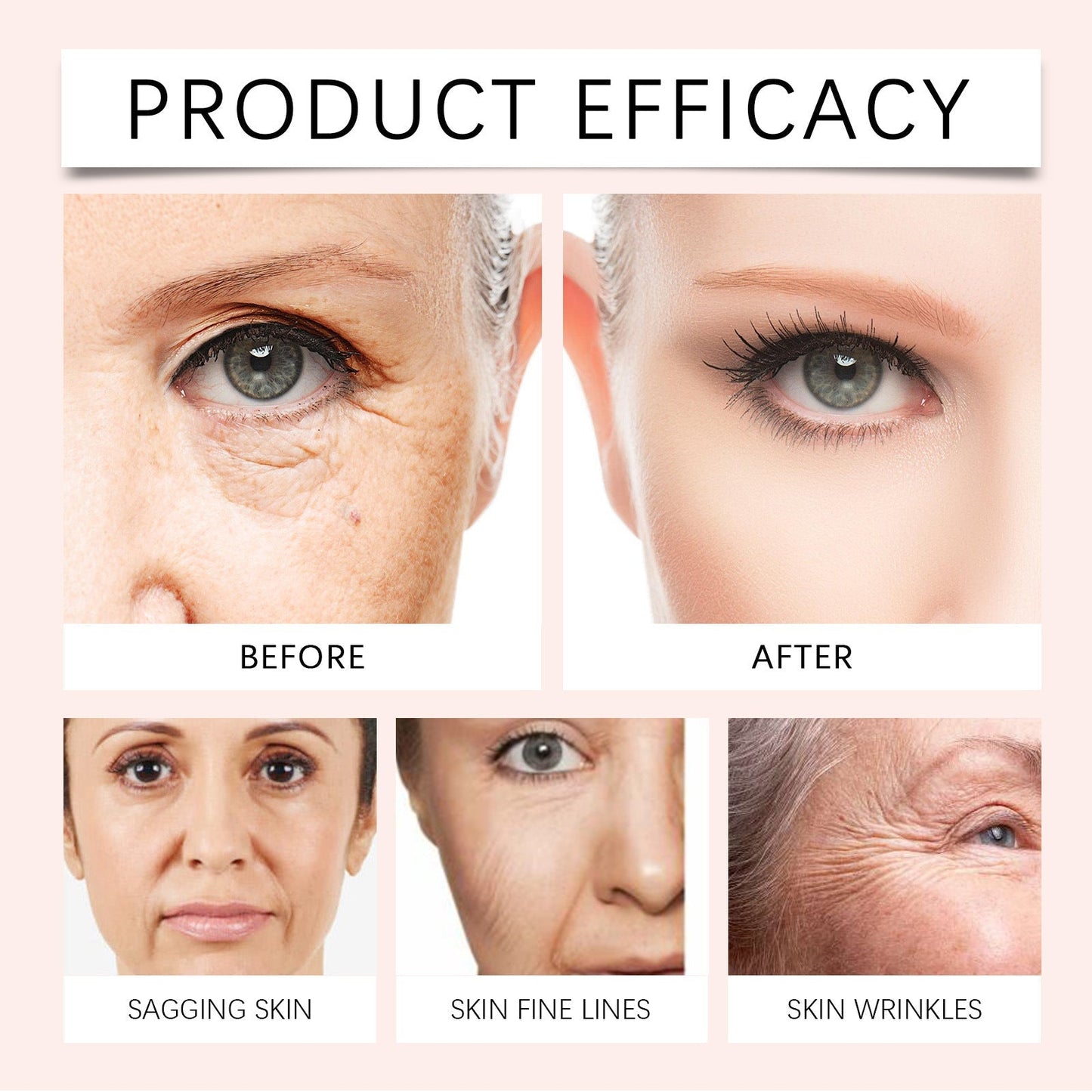 Jorondy™ – Anti-Aging Rimpelvuller met Vitamine C & Rozenbottelolie | Stralende Huid