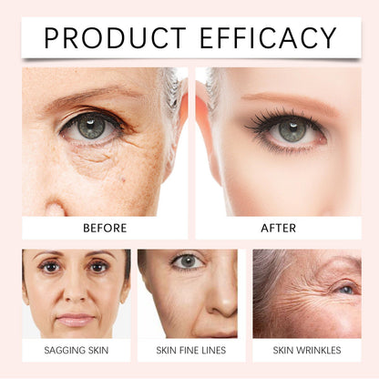 Jorondy™ – Anti-Aging Rimpelvuller met Vitamine C & Rozenbottelolie | Stralende Huid