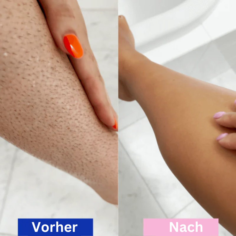 SilkGlow™ – Pijnloze laser-ontharer voor zijdezachte huid [50% Korting]