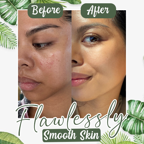 DermaTea™ – Groene Thee Masker Stick voor Diepe Poriënreiniging [1+1 Gratis]