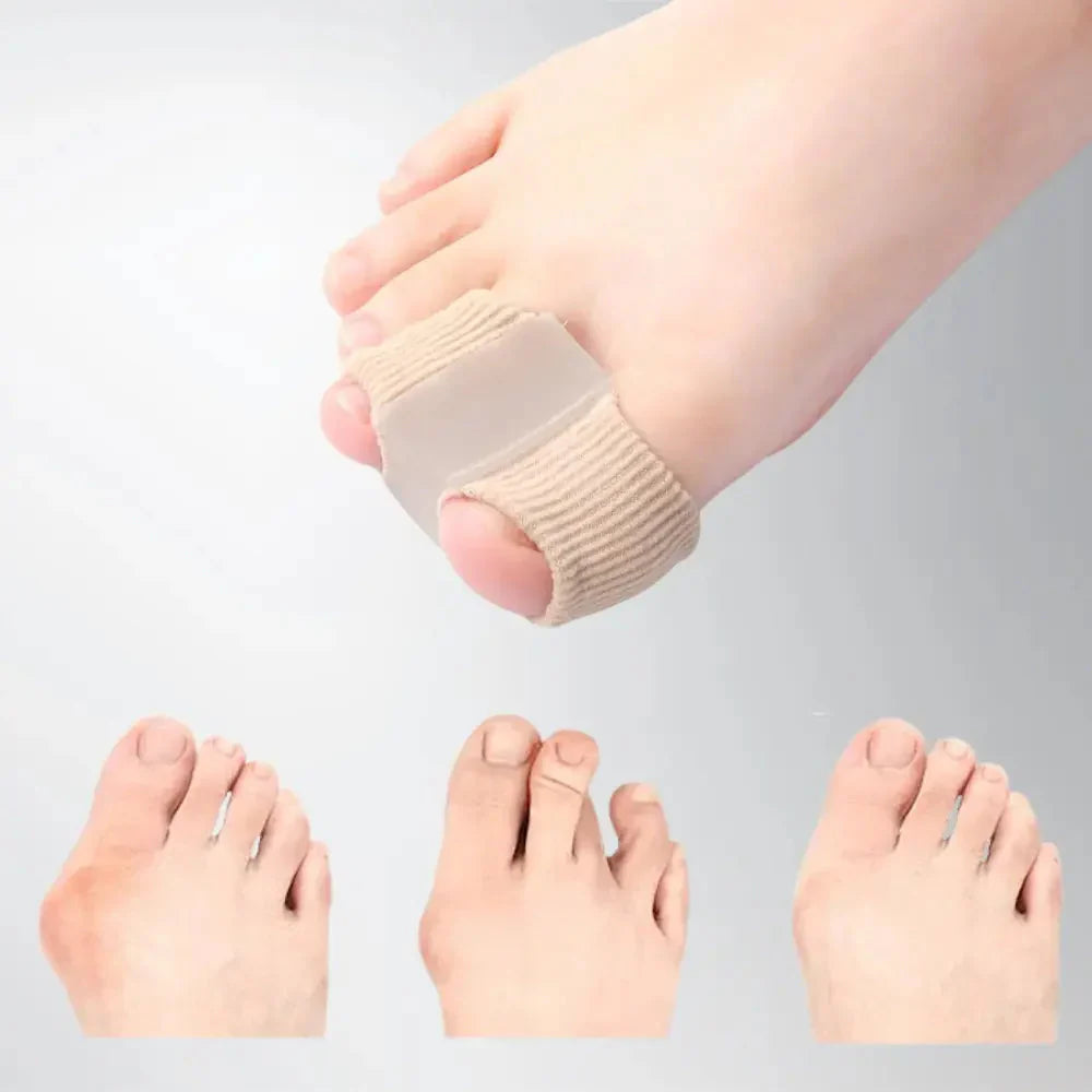 ToeCorrect™ – Zachte correctie van hallux & overlappende tenen [2 + 2 Gratis]