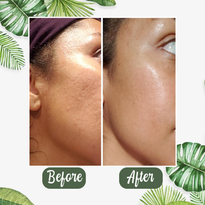 DermaTea™ – Groene Thee Masker Stick voor Diepe Poriënreiniging [1+1 Gratis]