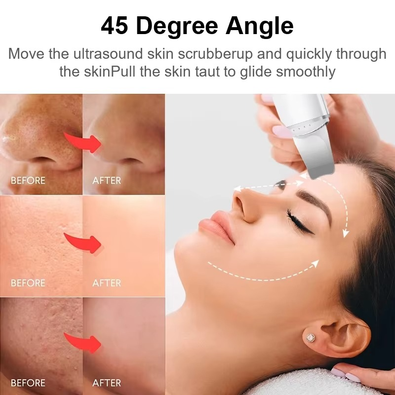 SkinSonic™ – Ultrasone Skin Scrubber voor Diepe Poriënreiniging & Stralende Huid
