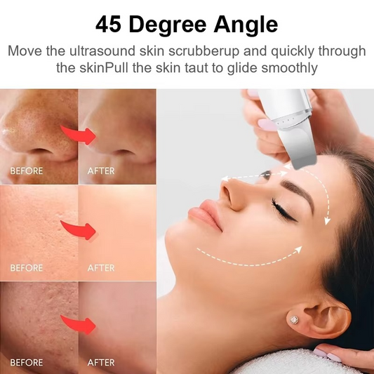 SkinSonic™ – Ultrasone huidreiniger voor diepe reiniging, zachte verzorging & stralende huid [50% Korting]