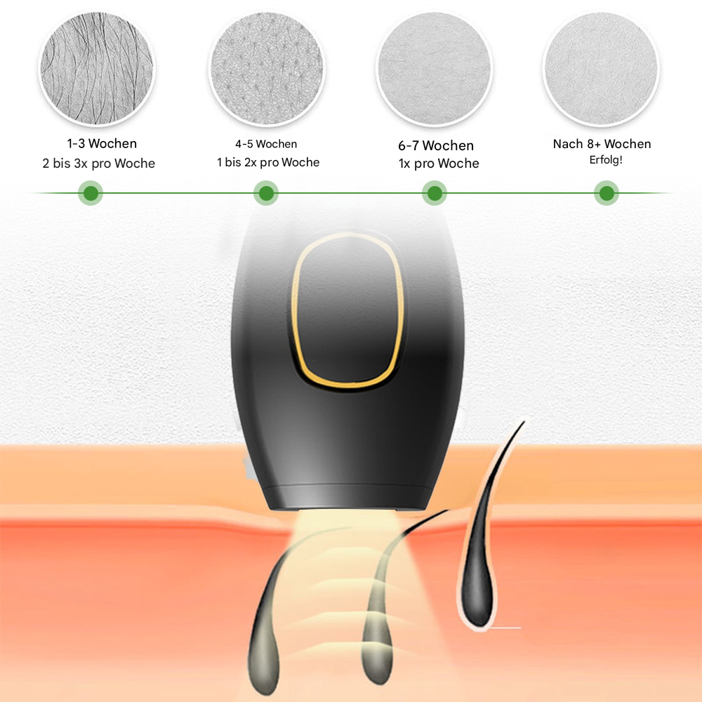 SilkGlow™ – Pijnloze laser-ontharer voor zijdezachte huid [50% Korting]