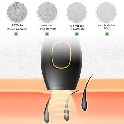 SilkGlow™ – Pijnloze laser-ontharer voor zijdezachte huid [50% Korting]