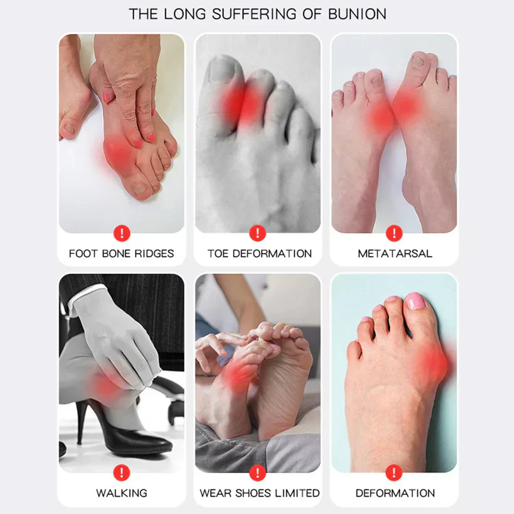 HalluxValgus™ - Jouw comfortabele oplossing voor pijnvrije voeten! [1 + 1 Gratis]