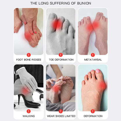 HalluxValgus™ - Jouw comfortabele oplossing voor pijnvrije voeten! [1 + 1 Gratis]