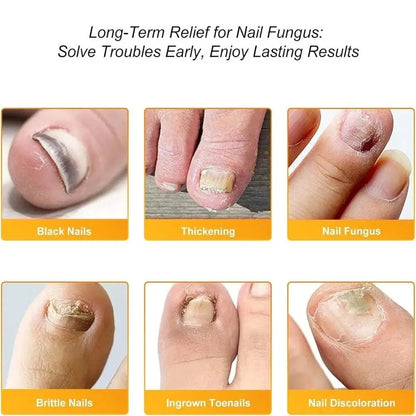 FungalPatch™ – Schimmelnagel Patch voor Snelle & Zichtbare Nagelverzorging