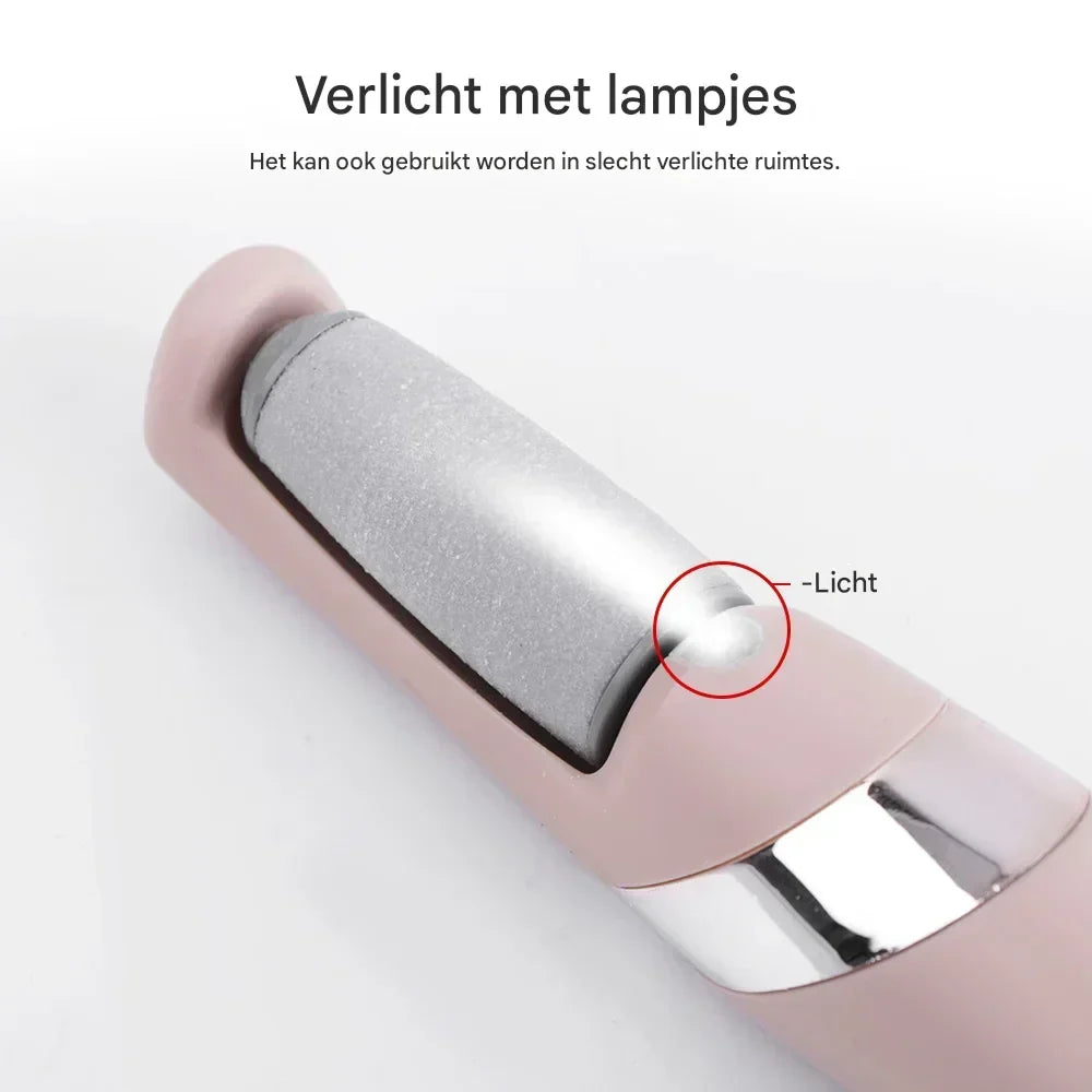 Smoovix™ - Oplaadbare elektrische eeltverwijderaar [50% Korting]