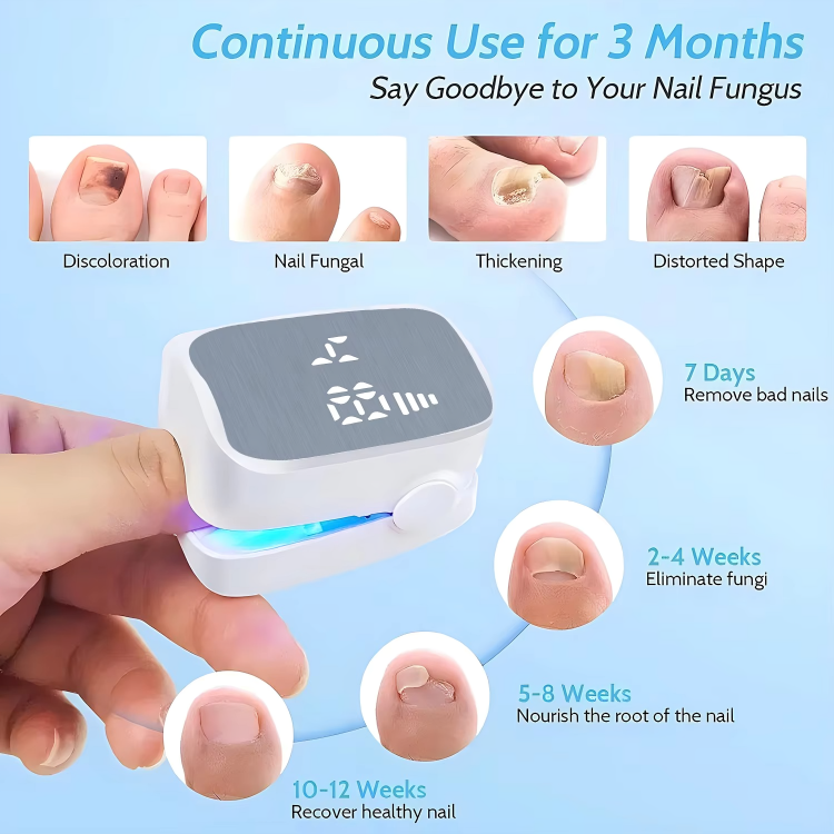 FungiZap™ – Voor gezonde, heldere en sterke nagels zonder chemische middelen of dure behandelingen [50% Korting]