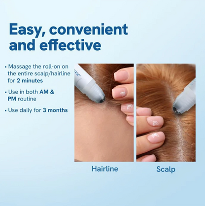 StrandBoost™ – Haargroei-serumroller tegen haaruitval voor sterk, vol haar [1 + 1 Gratis]