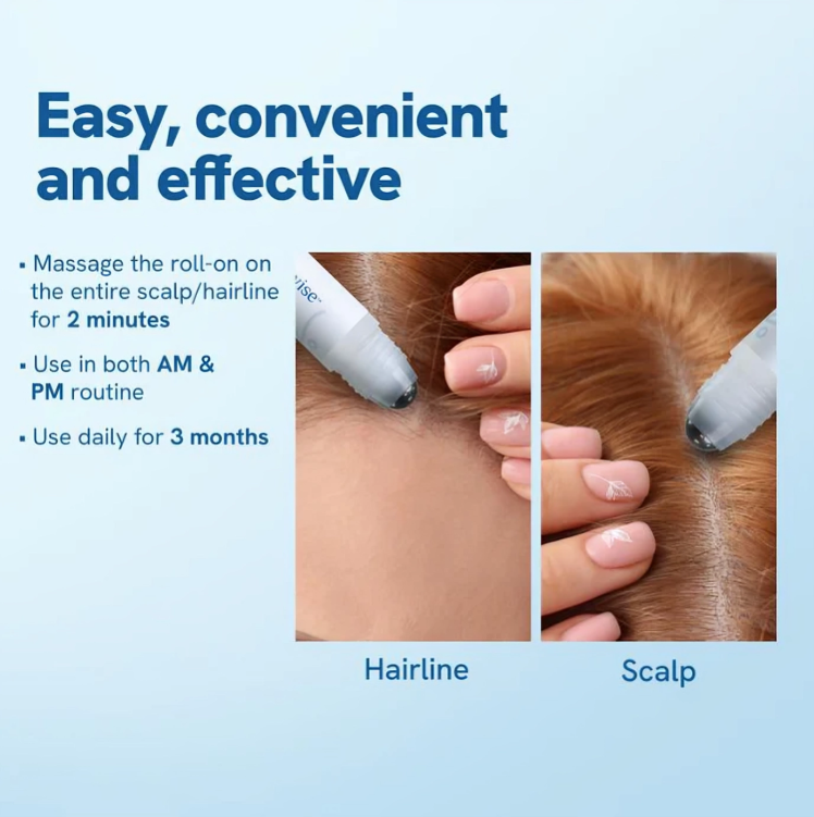 StrandBoost™ – Haargroei-serumroller tegen haaruitval [1 + 1 Gratis]