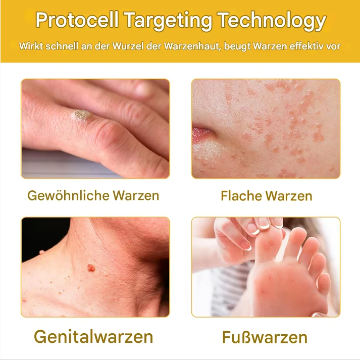 TagAway™ – Plantaardige Wrat & Huidtag Verwijdering | 1 + 1 Gratis